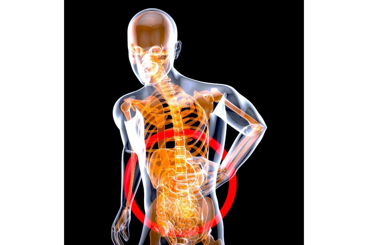 IBS-C Treatment